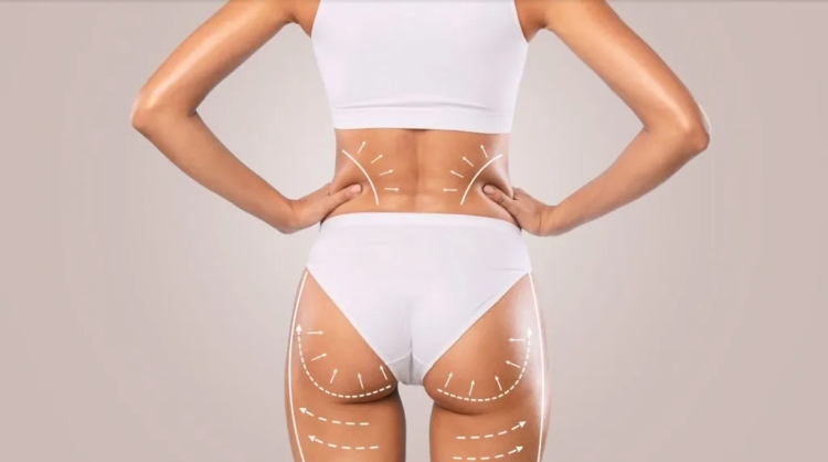 Why Dubai is Leading the Way in Butt Fat Transfer Procedures